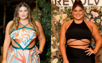 The Truth About Remi Bader’s Weight Loss Transformation